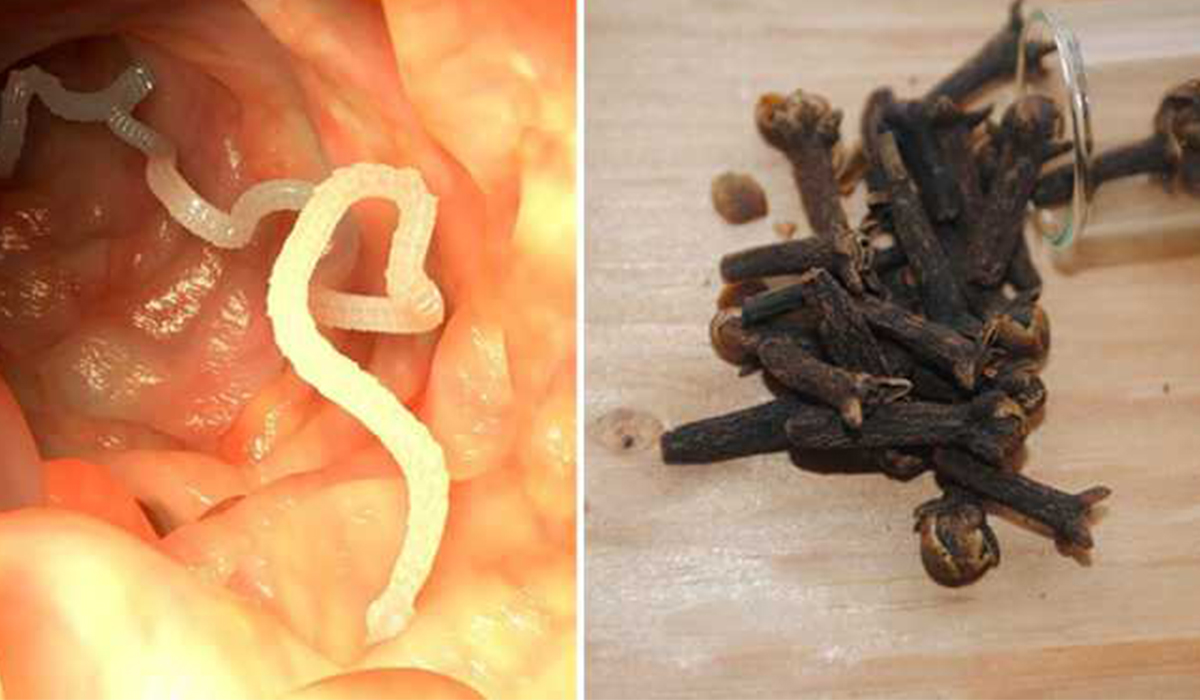 10 Warning Signs Your Body is Full of Parasites and 7 Foods That Can Help Kill Them